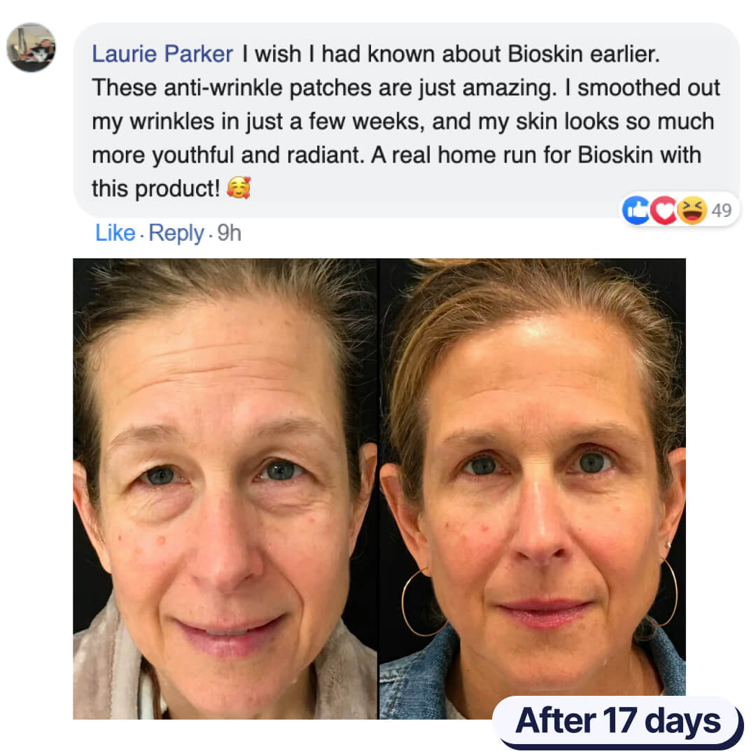 The BioSkin™ Patches : Say goodbye to your wrinkles now !