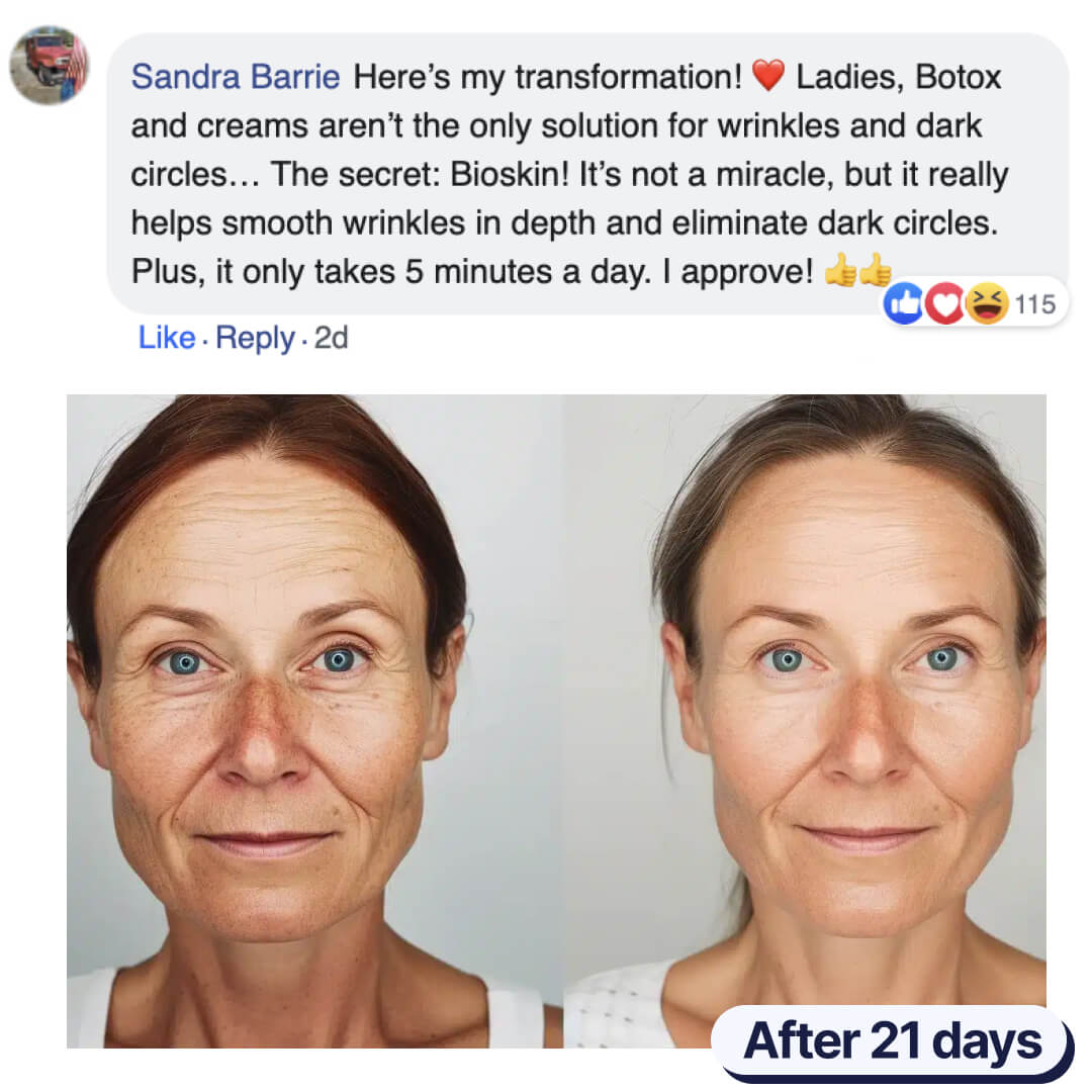 The BioSkin™ Patches : Say goodbye to your wrinkles now !