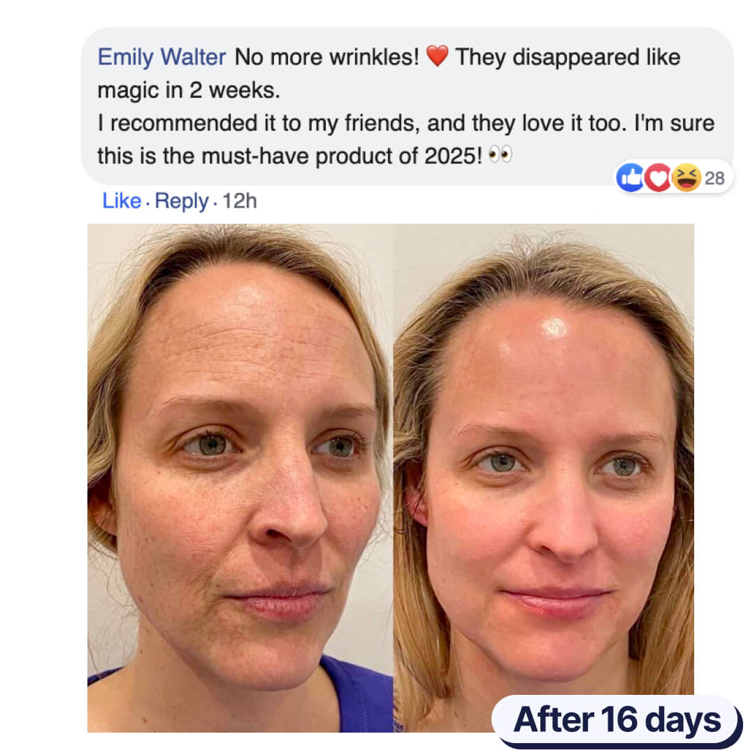 The BioSkin™ Patches : Say goodbye to your wrinkles now !
