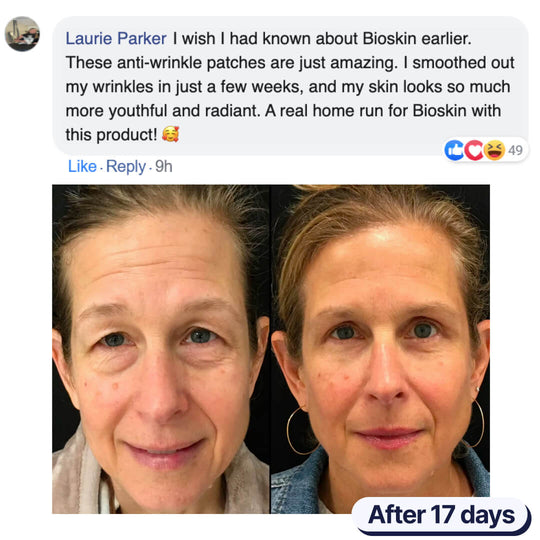 The BioSkin™ Patches : Say goodbye to your wrinkles now !