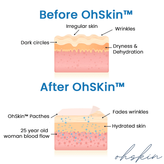 The OhSkin™ Patches : Say goodbye to your wrinkles now ! 2
